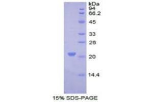SDS-PAGE analysis of Human COL8A1 Protein. (COL8A1 Protein)