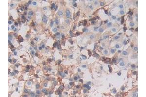 Detection of MHCC in Human Stomach Tissue using Polyclonal Antibody to Major Histocompatibility Complex Class I C (MHCC) (MHCC (AA 48-305) Antikörper)