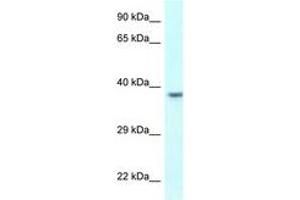Image no. 1 for anti-Uroplakin 3B (UPK3B) (AA 247-296) antibody (ABIN6747778) (Uroplakin 3B Antikörper  (AA 247-296))