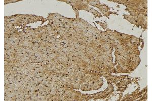 ABIN6272967 at 1/100 staining Mouse muscle tissue by IHC-P.
