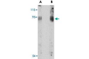 Western blot analysis of BICD2 in A-549 cell lysate with BICD2 polyclonal antibody  at (A) 1 and (B) 2 ug/mL . (BICD2 Antikörper  (C-Term))