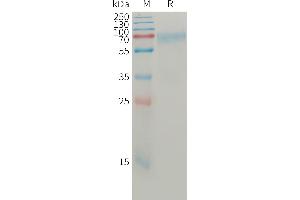 SDS-PAGE (SDS) image for Angiopoietin 2 (ANGPT2) (AA 19-496) protein (His tag) (ABIN7491343)