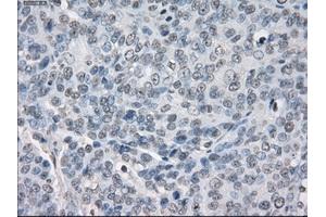 Immunohistochemical staining of paraffin-embedded Kidney tissue using anti-PPP5Cmouse monoclonal antibody. (PP5 Antikörper)