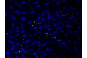 ABIN6266515 at 1/200 staining human liver tissue cells by ICC/IF. (COL2A1 Antikörper  (N-Term))