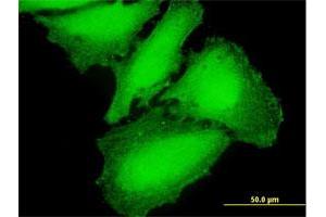 Immunofluorescence of purified MaxPab antibody to CAMK2G on HeLa cell. (CAMKII gamma Antikörper  (AA 1-527))