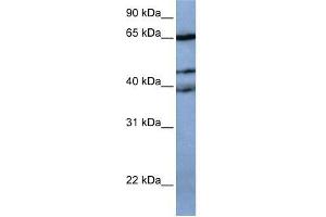 Western Blot showing ZNF681 antibody used at a concentration of 1-2 ug/ml to detect its target protein. (ZNF681 Antikörper  (N-Term))