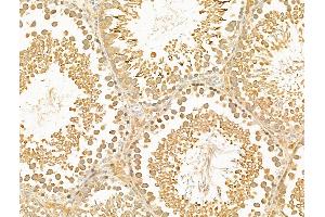 ABIN7094886 and ABIN7098939 at 1/100 staining Rat testis tissue by IHC-P. (PSME4 Antikörper  (C-Term))