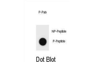 Dot blot analysis of TSC1 Antibody (Phospho ) Phospho-specific Pab (ABIN1881925 and ABIN2839960) on nitrocellulose membrane.