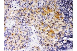 IHC analysis of SKAP55 using anti-SKAP55 antibody (ABIN3044545).