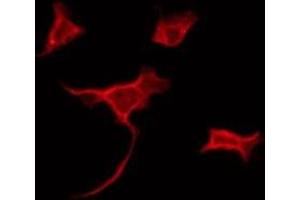 ABIN6275156 staining Hela by IF/ICC. (GLRB Antikörper  (Internal Region))