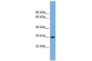 WB Suggested Anti-RAB40C Antibody Titration: 0. (RAB40C Antikörper  (N-Term))