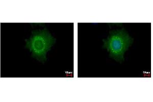 ICC/IF Image DDX6 antibody detects DDX6 protein at cytoplasm and P body by immunofluorescent analysis. (DDX6 Antikörper  (Center))