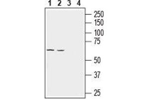 Western blot analysis of rat lung (lanes 1 and 3) and mouse lung (lanes 2 and 4) lysates: - 1, 2. (SLC43A1 Antikörper  (4th Extracellular Loop))
