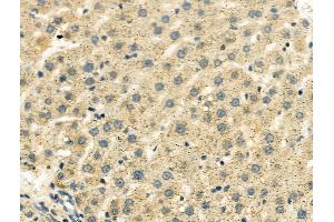 ABIN6260258 and ABIN6276616 at 1/100 staining Rat liver tissue by IHC-P.