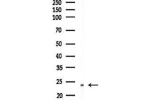 anti-Transmembrane Protein 199 (TMEM199) antibody