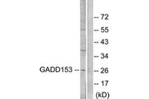 Western blot analysis of extracts from LOVO cells, treated with serum 10% 15', using GADD153 Antibody. (DDIT3 Antikörper  (AA 91-140))