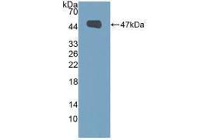 Western blot analysis of recombinant Human MUC1. (MUC1 Antikörper  (AA 1098-1255))