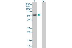 Western Blot analysis of OSMR expression in transfected 293T cell line by OSMR MaxPab polyclonal antibody.