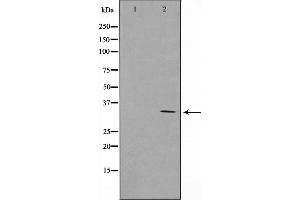 Western blot analysis on Jurkat cell lysate using Cyclin G Antibody,The lane on the left is treated with the antigen-specific peptide. (Cyclin G1 Antikörper  (Internal Region))