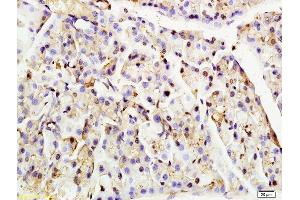 Formalin-fixed and paraffin embedded rat pancreas tissue labeled with Anti-Nucleoporin p62 Polyclonal Antibody, Unconjugated (ABIN681928) at 1:200 followed by conjugation to the secondary antibody