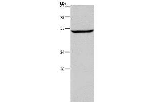Western Blot analysis of Raji cell using IMPDH1 Polyclonal Antibody at dilution of 1:450