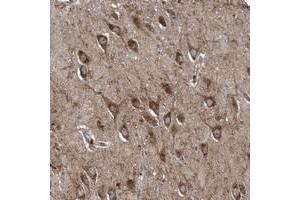 Immunohistochemical staining of human hippocampus with LYRM4 polyclonal antibody  shows strong cytoplasmic positivity in neuronal cells at 1:50-1:200 dilution.