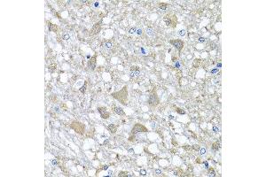 Immunohistochemistry of paraffin-embedded rat brain using VPS37A antibody at dilution of 1:100 (x40 lens). (VPS37A Antikörper)