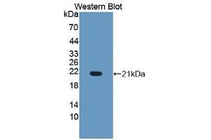 Detection of Recombinant RBM3, Human using Polyclonal Antibody to RNA Binding Motif Protein 3 (RBM3) (RBM3 Antikörper  (AA 1-157))