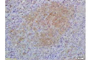 Formalin-fixed and paraffin embedded mouse lymphoma labeled with Anti-IL-17RA/CD217 Polyclonal Antibody, Unconjugated (ABIN747908) at 1:200 followed by conjugation to the secondary antibody and DAB staining (IL17RA Antikörper  (AA 201-300))