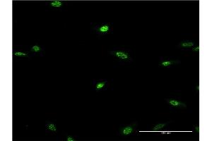 Immunofluorescence of monoclonal antibody to LHX2 on HeLa cell.