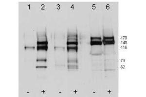 Western blot using ’s affinity purified anti-c-Met pY1349pY1356 antibody shows detection of phosphorylated c-Met. (c-MET Antikörper  (pTyr1249, pTyr1356))