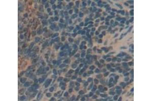 IHC-P analysis of Human Tissue, with DAB staining. (KIR2DS4 Antikörper  (AA 22-302))