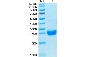 Cynomolgus IL-17F on Tris-Bis PAGE under reduced condition. (IL17F Protein (AA 31-163) (His tag))