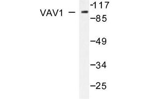 Image no. 2 for anti-Vav 1 Oncogene (VAV1) antibody (ABIN271858) (VAV1 Antikörper)