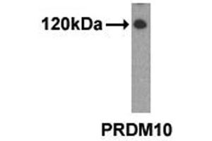 Western analysis of extracts from 293 cells using PRDM10 antibody.