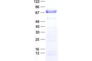 Validation with Western Blot (SOCS6 Protein (His tag))