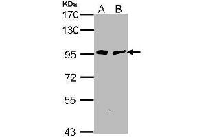 WB Image Sample (30 ug of whole cell lysate) A: H1299 B: Hela 7. (Gelsolin Antikörper  (C-Term))