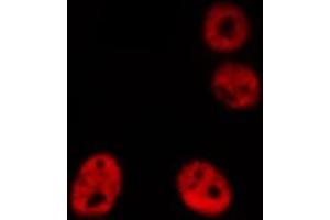 ABIN6276866 staining HeLa cells by IF/ICC. (AIRE Antikörper  (Internal Region))