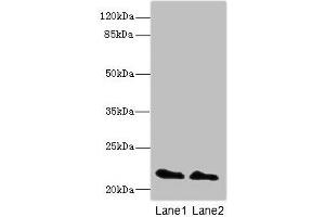 Western blot All lanes: KRAS antibody at 2 μg/mL Lane 1: Mouse brain tissue Lane 2: Mouse kidney tissue Secondary Goat polyclonal to rabbit IgG at 1/10000 dilution Predicted band size: 22 kDa Observed band size: 22 kDa (K-RAS Antikörper  (AA 2-168))