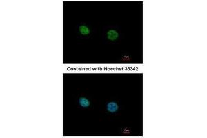 ICC/IF Image Immunofluorescence analysis of paraformaldehyde-fixed HeLa, using NR2C2, antibody at 1:500 dilution. (TR4 Antikörper)