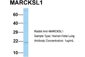 Host: Rabbit  Target Name: MARCKSL1  Sample Tissue: Human Fetal Lung  Antibody Dilution: 1.