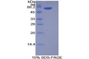 SDS-PAGE analysis of Mouse Integrin alpha 9 Protein. (ITGA9 Protein)