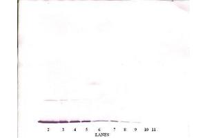 Image no. 2 for anti-Interferon gamma (IFNG) antibody (ABIN464926)