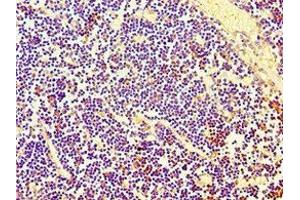 Immunohistochemistry of paraffin-embedded human thymus tissue using ABIN7158664 at dilution of 1:100 (PBK Antikörper  (AA 1-322))