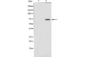Western blot analysis on HepG2 cell lysate using MAP3K3 Antibody,The lane on the left is treated with the antigen-specific peptide.