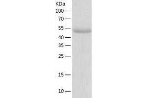 Western Blotting (WB) image for Kruppel-Like Factor 4 (Gut) (KLF4) (AA 1-479) protein (His tag) (ABIN7123699) (KLF4 Protein (AA 1-479) (His tag))