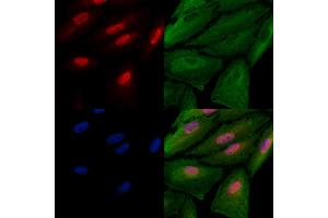 ABIN6262222 and ABIN6278578 staining  cells by IF/ICC.