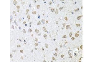 Immunohistochemistry of paraffin-embedded Mouse brain using TARS Polyclonal Antibody at dilution of 1:100 (40x lens). (TARS Antikörper)