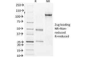 SDS-PAGE Analysis Purified BCL-6 Mouse Monoclonal Antibody (BCL6/1982). (BCL6 Antikörper  (AA 256-389))