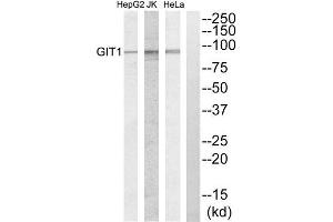 Western Blotting (WB) image for anti-GIT1 (GIT1) (C-Term) antibody (ABIN1850115) (GIT1 Antikörper  (C-Term))